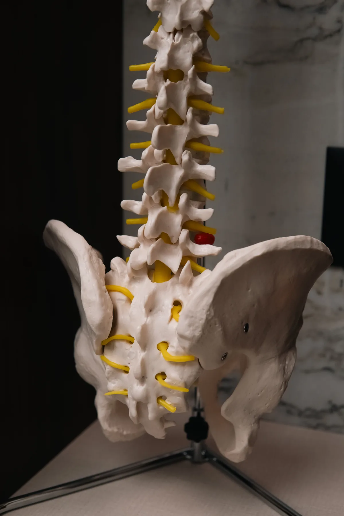 Modelo anatômico da coluna vertebral utilizado no consultório de medicina da dor